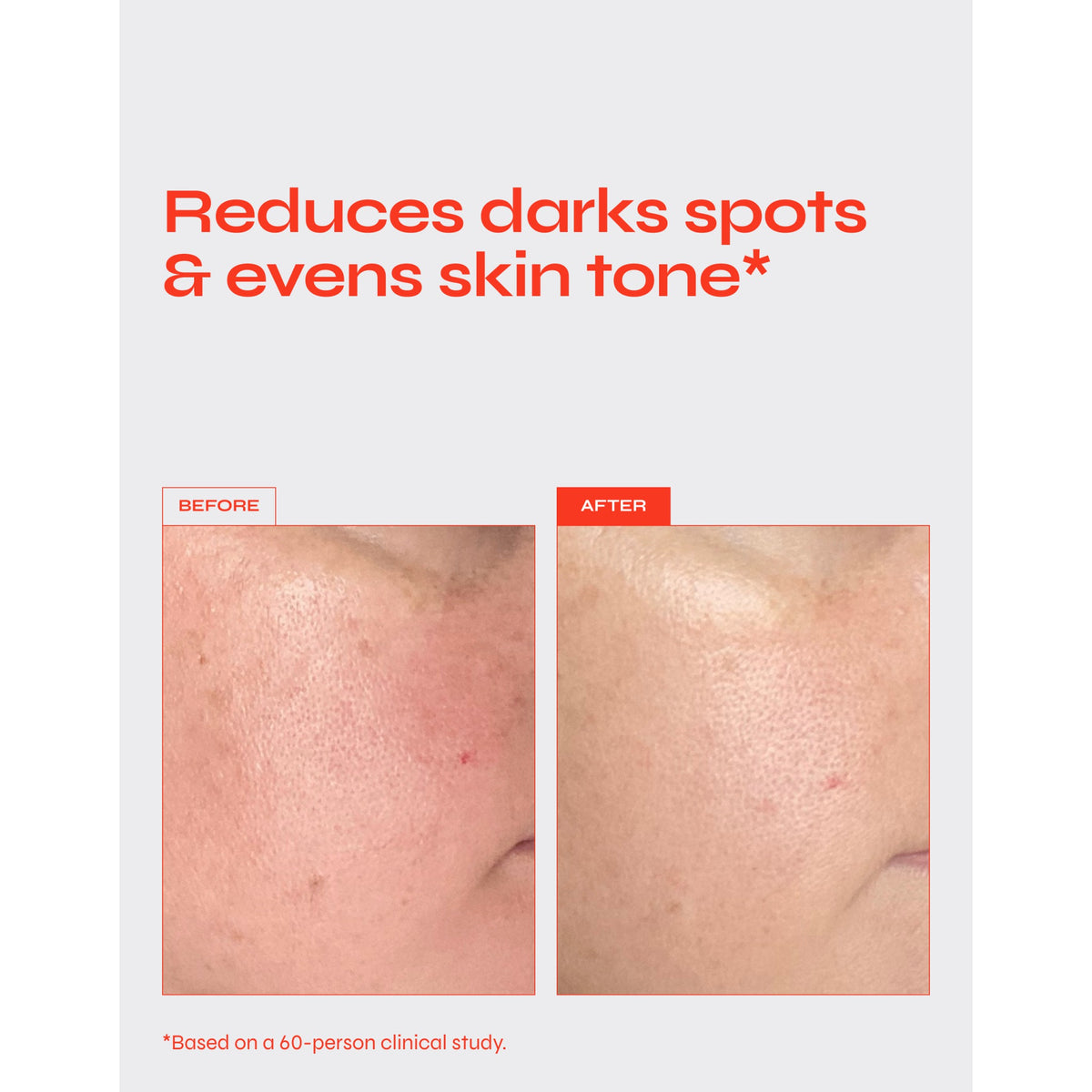Facile Brighten Targeted Pigment Serum