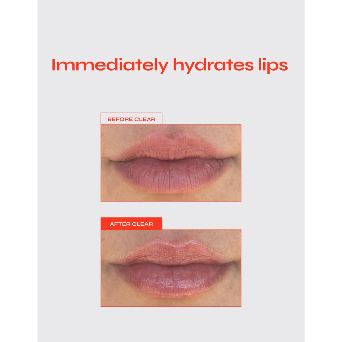 Facile Lip Jelly - Clear Lip Moisturizer